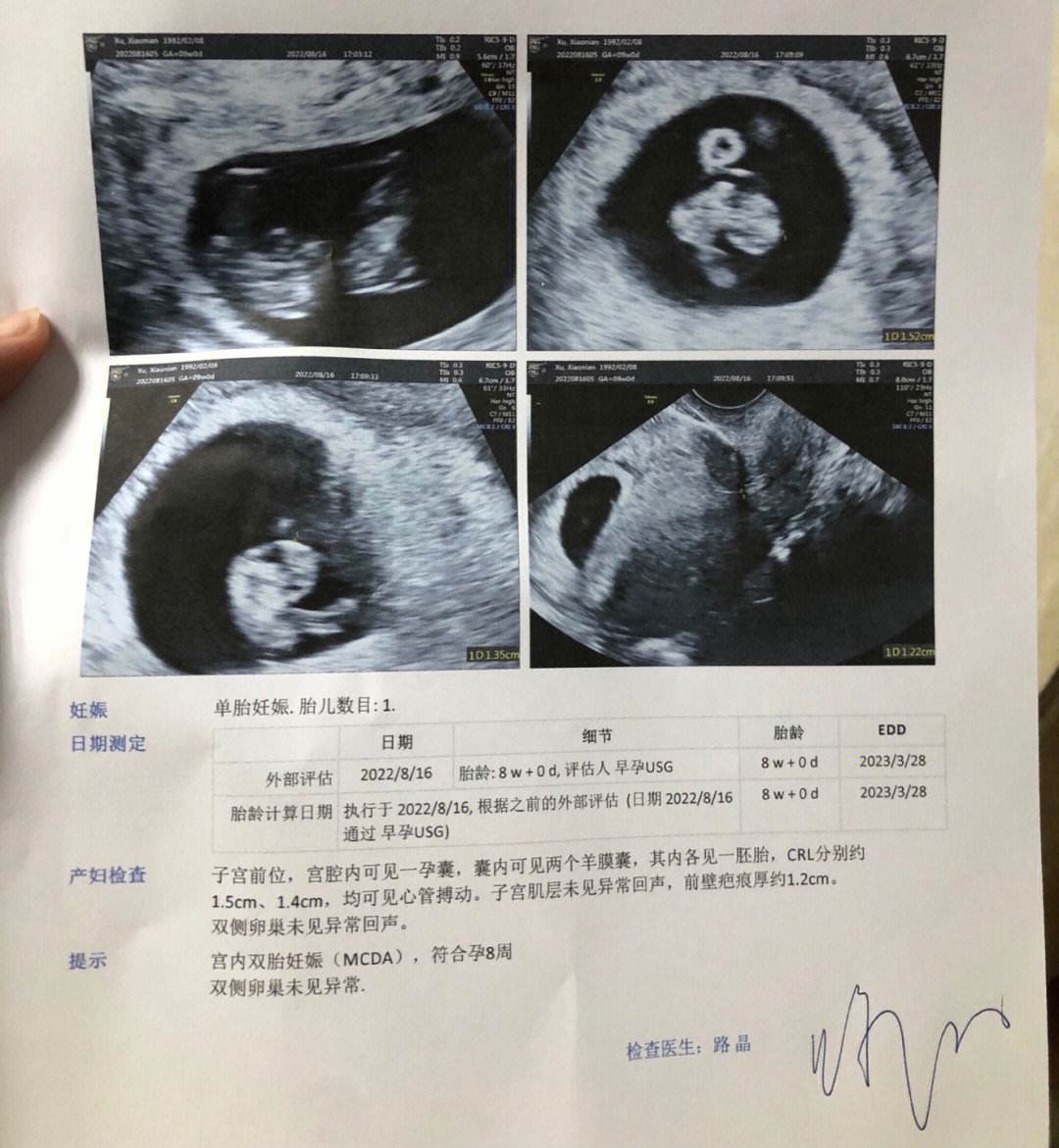 五万分之一的概率！麦迪逊女友又怀双胞胎已育有3娃